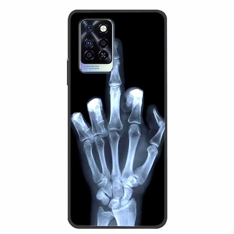 for infinix note 10 pro nfc case shockproof soft silicone tpu back cover for infinix note 10 plus phone case note10 pro plus free global shipping