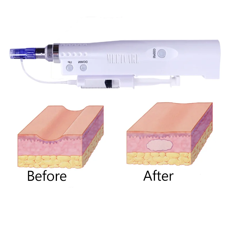 Профессиональный массажер с микроиглами мезо ручка без игл портативный впрыск