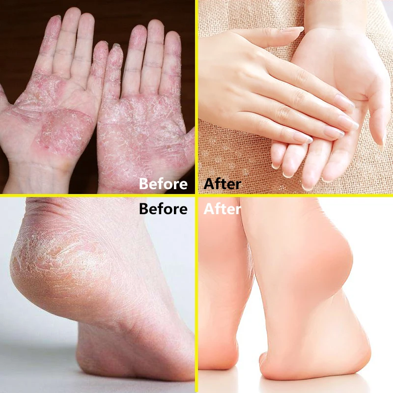 Конское масло крем для рук пятки пилинг ног восстанавливающий против сухой