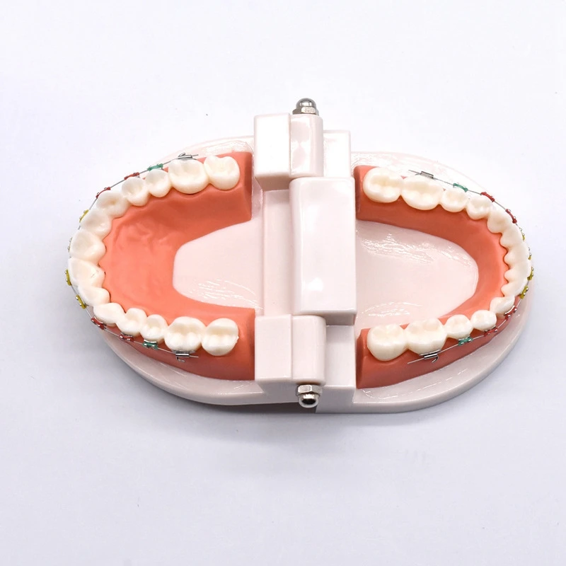 Ортодонтическая лечебная модель с ортодонтическим металлическим керамическим