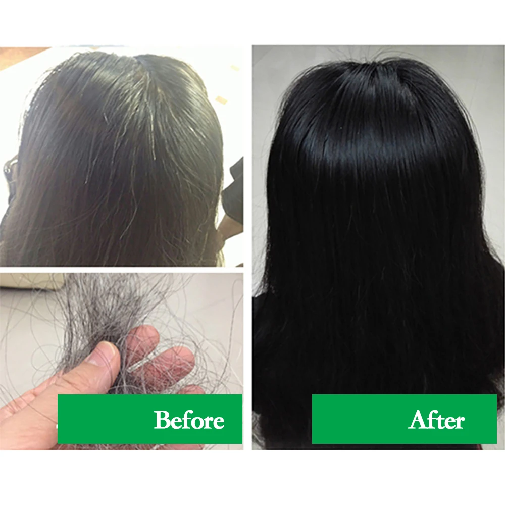 

Herbal Natural Polygonum Multiflorum Shampoo Plant Liquid Grey Hair White Hair Removal Turn Permanent Black Hair Care 300ml