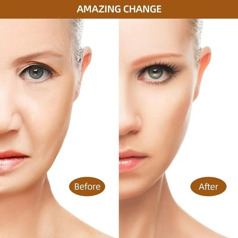 Крем против морщин увлажняющий крем лифтинг питательный отбеливающий G4N1 |