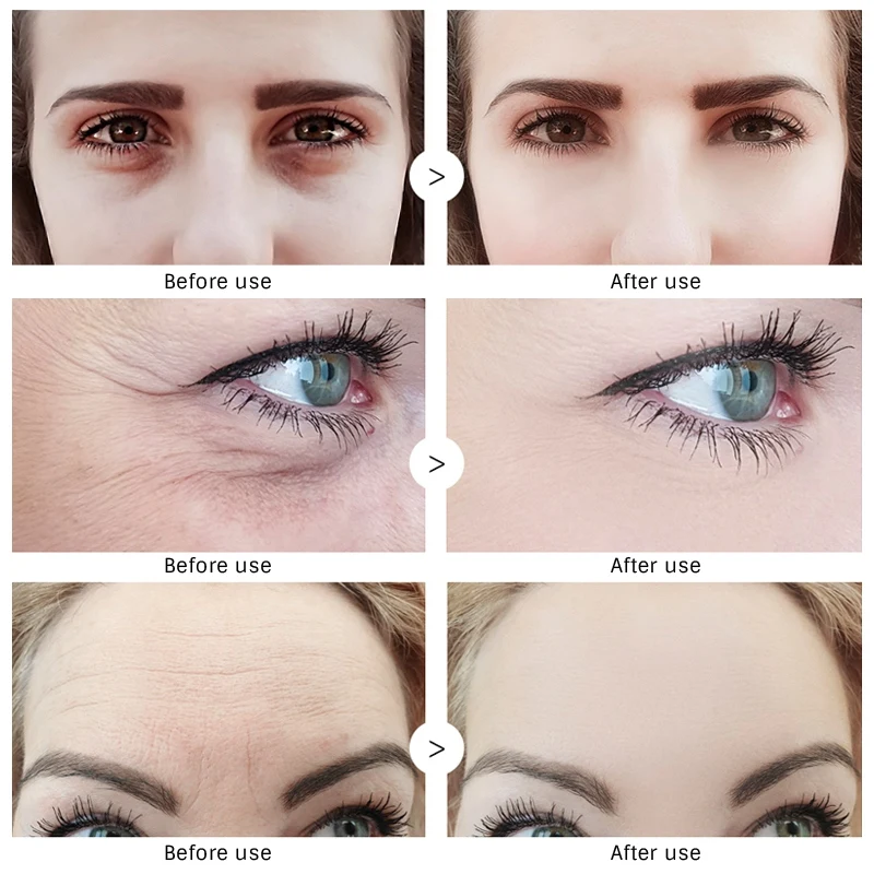 EyeCream мгновенное удаление мешков для глаз укрепляющие глаза против темных кругов