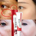 Эффективный отбеливающий крем для лица 20 г, увлажняющий крем для отбеливания и защиты от веснушек, крем для осветления пятен, крем для лица, разглаживание