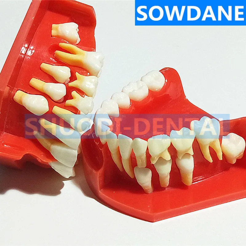 Стоматологическая детская модель выпадающих зубов сменная постоянные зубы