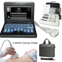 portable b untrasound diagnostic system cms600p2 laptop machine digital ultrasound scanner 3 5 convex probe ultrasonic systems
