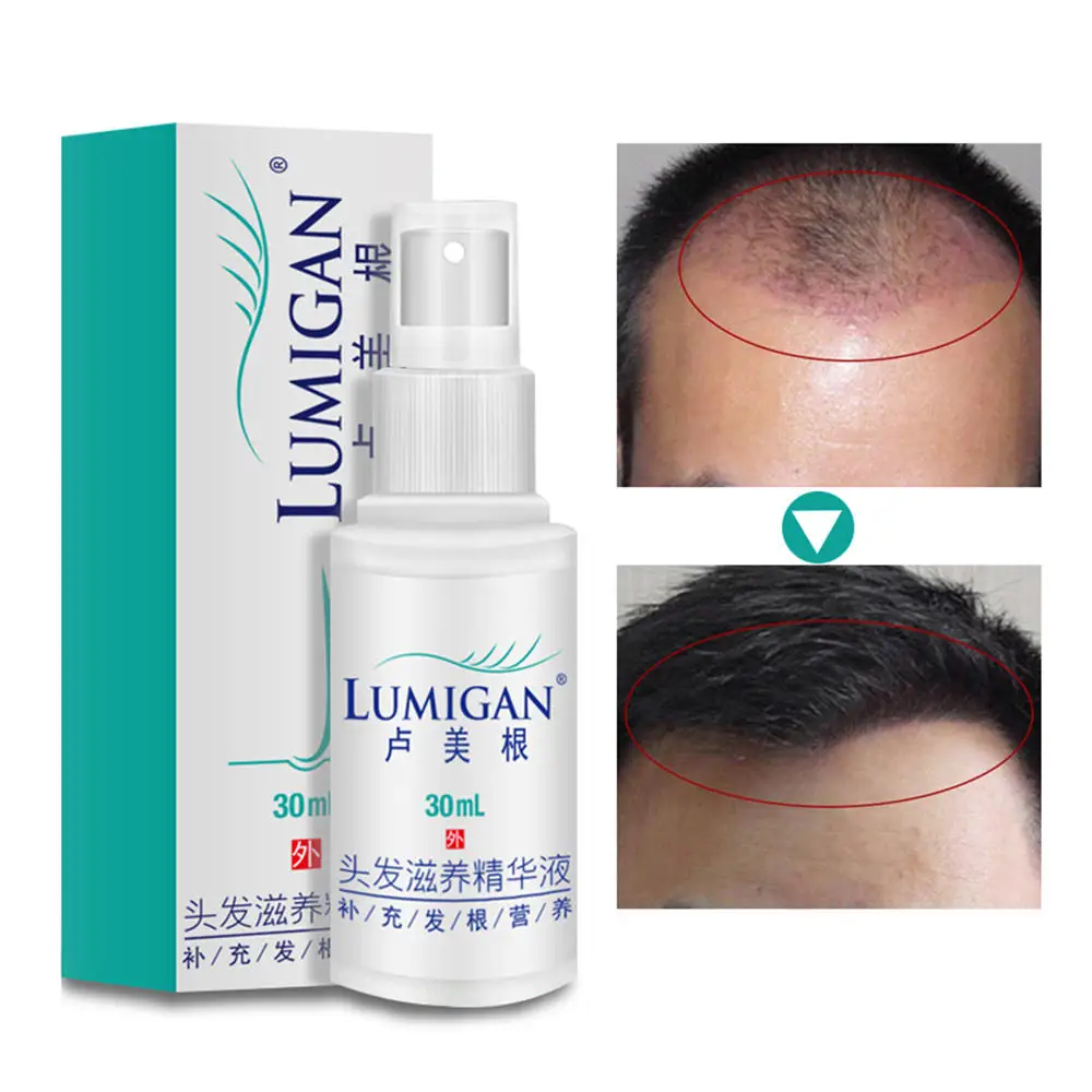 Спрей натуральный для ухода за волосами эссенция против выпадения волос