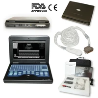 cms600p2 portable ultrasound scanner laptop machine ultrasonic systems 3 5 mhz cardiac probemicro convex probe cd fda