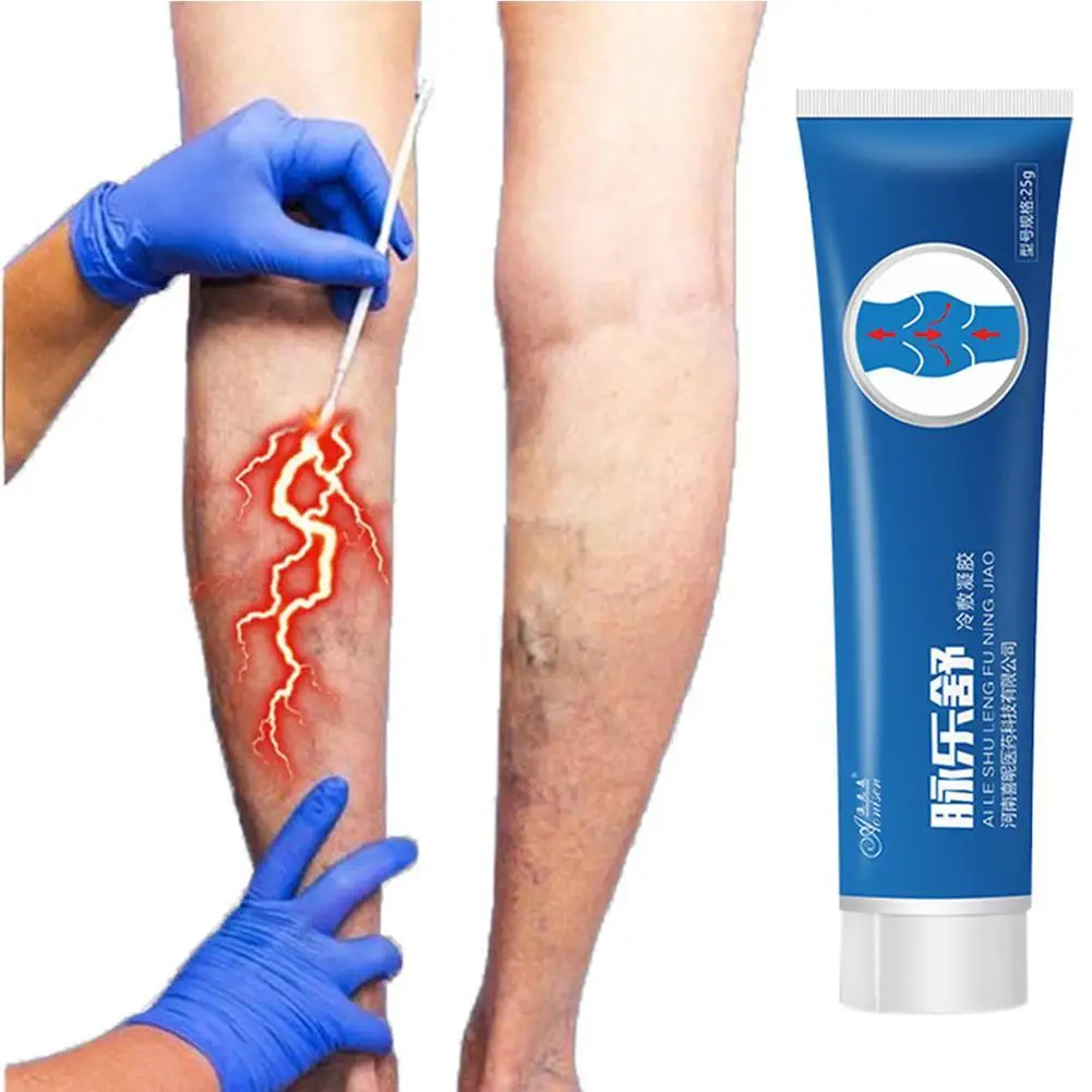 

New Varicose Vein Cream Effective Varicoses Veins Vasculitis Unguent Salve Treatment Ointment Compress Cold Gel 20g L6B9