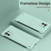Ultra Thin Frameless Phone Case Cover For Xiaomi 10T Lite Redmi Note 10S Pro Max Poco Cover