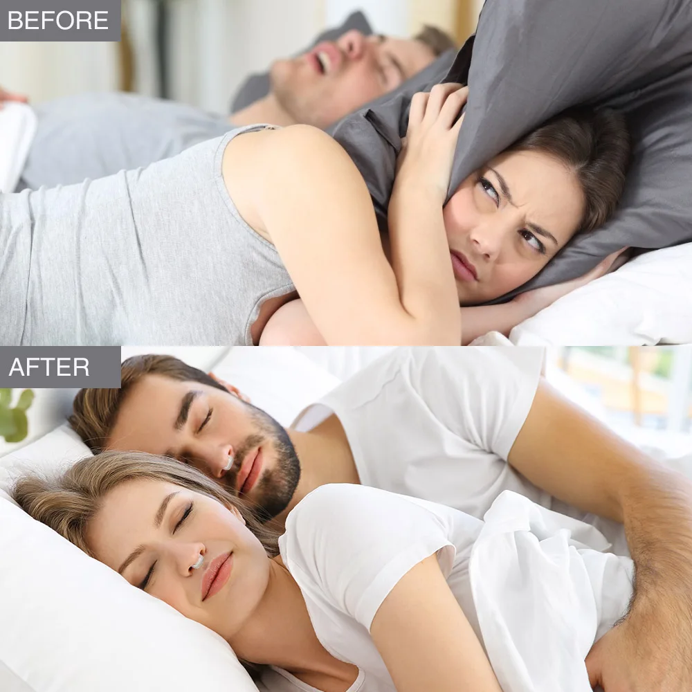 smart anti snore device