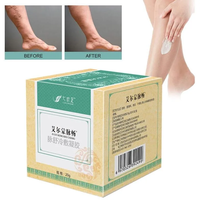 

Эффективный крем от варикозного расширения вен, 20 г, лечение вен, китайская травяная медицина, Здоровье ног