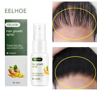 ginger prevents hair loss serum fast growth hair oil spray products treatment thinning hair dry frizz men woman %e2%80%8bscalp nursing