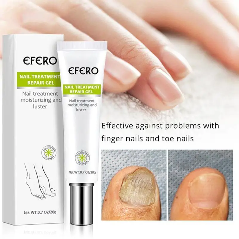 20g Nail Repair Cream Treatment Serum Nail Fungus Removal Nail Cream Gel Infection Anti Treatment Fungal J4V4