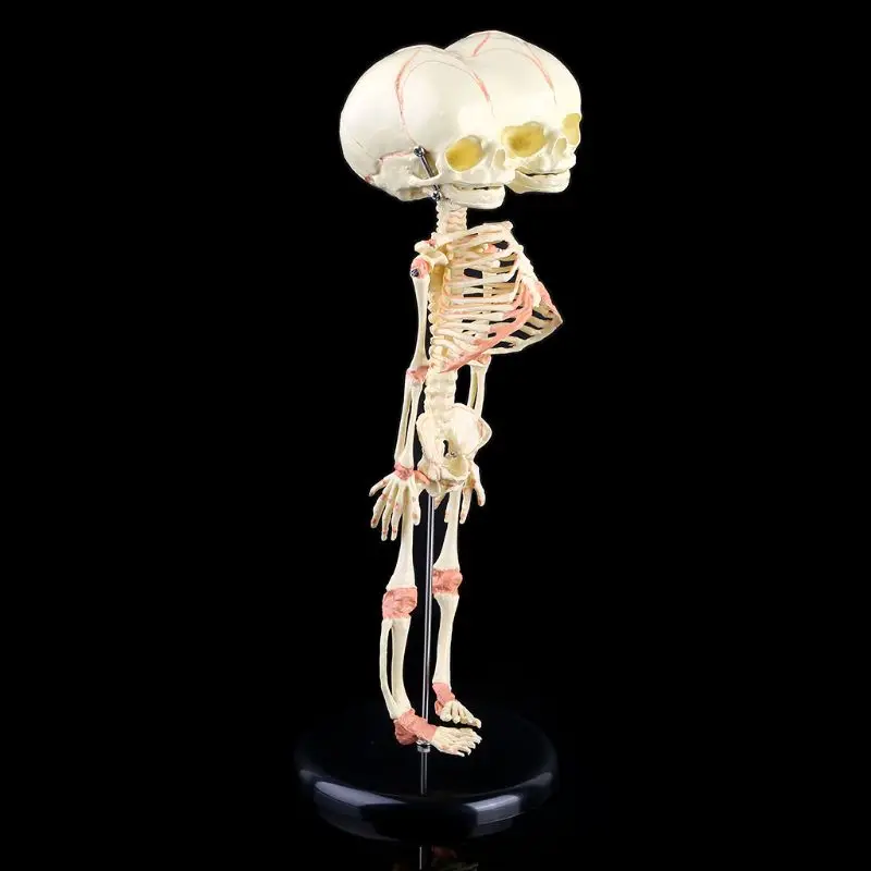 

Human Baby Deformed Head Skull Research Model Skeleton Anatomical Brain Anatomy 77HA