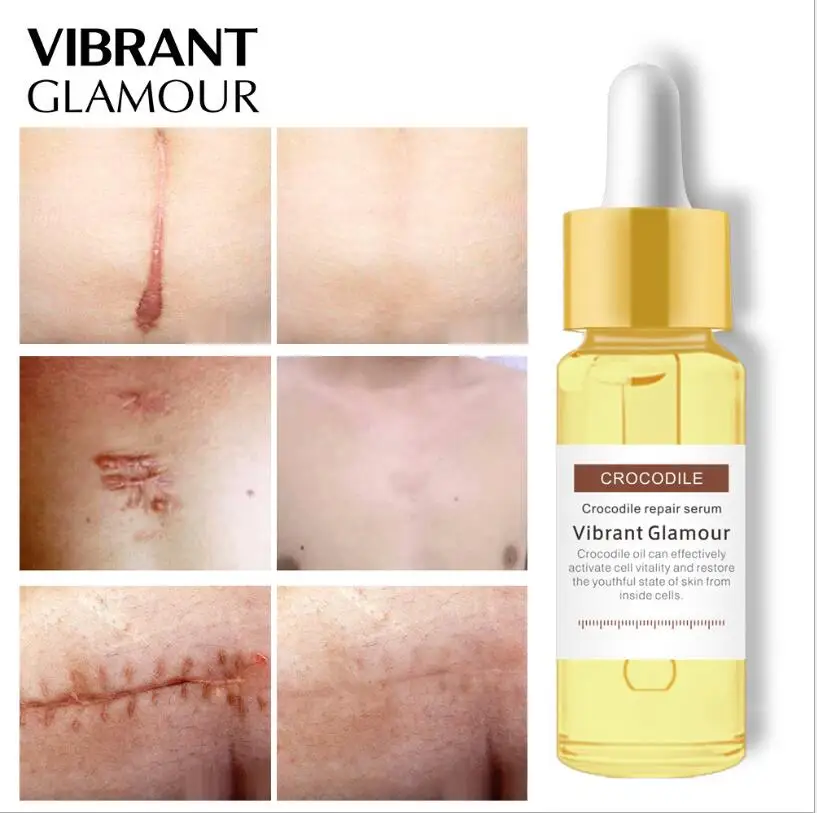Эссенция для замены кожи крокодила | Красота и здоровье
