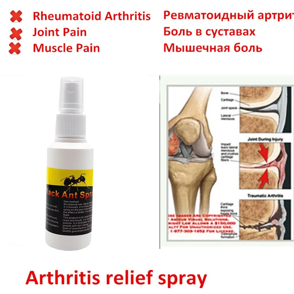 Китайский медицинский бальзам черный муравей избавляющий от боли эфирные масла