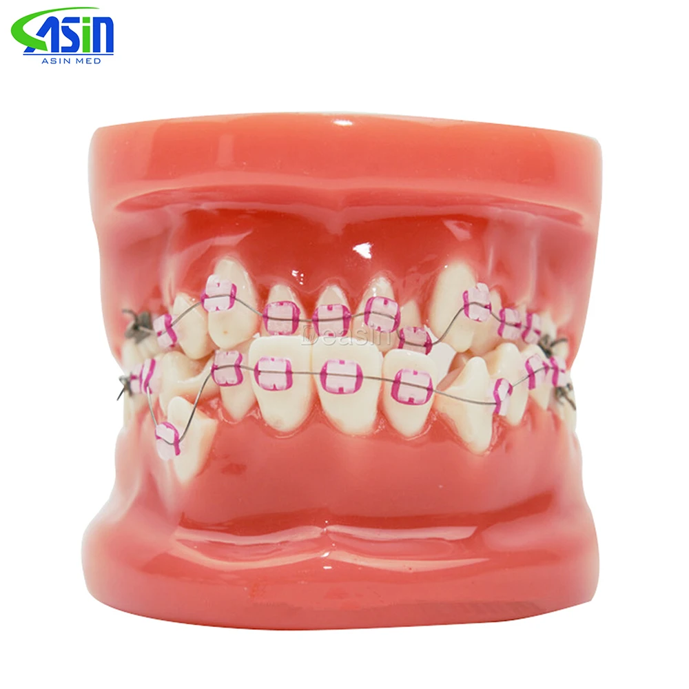 Orthodontic tooth model with Ceramic bracket model Doctor patient communication teaching model dental materials