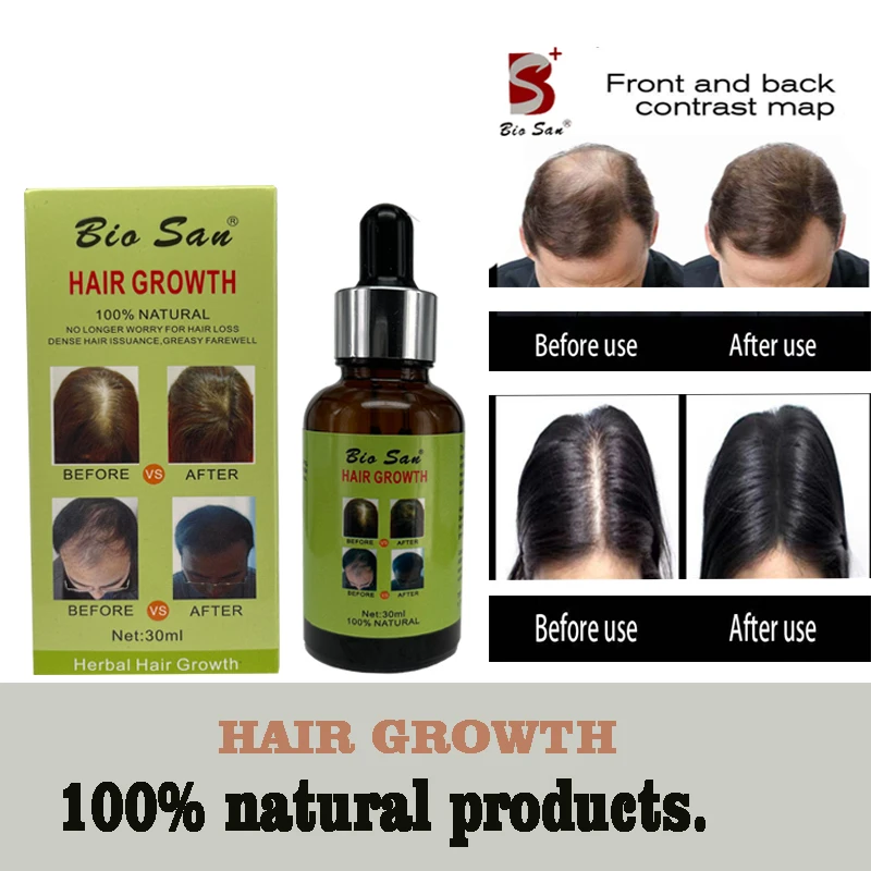Hair Growth Care Essential Vitamins Hair Oil Hair Restorer Promote Fast Hair Growth For Men And Women Fast Hair Growth 30ML