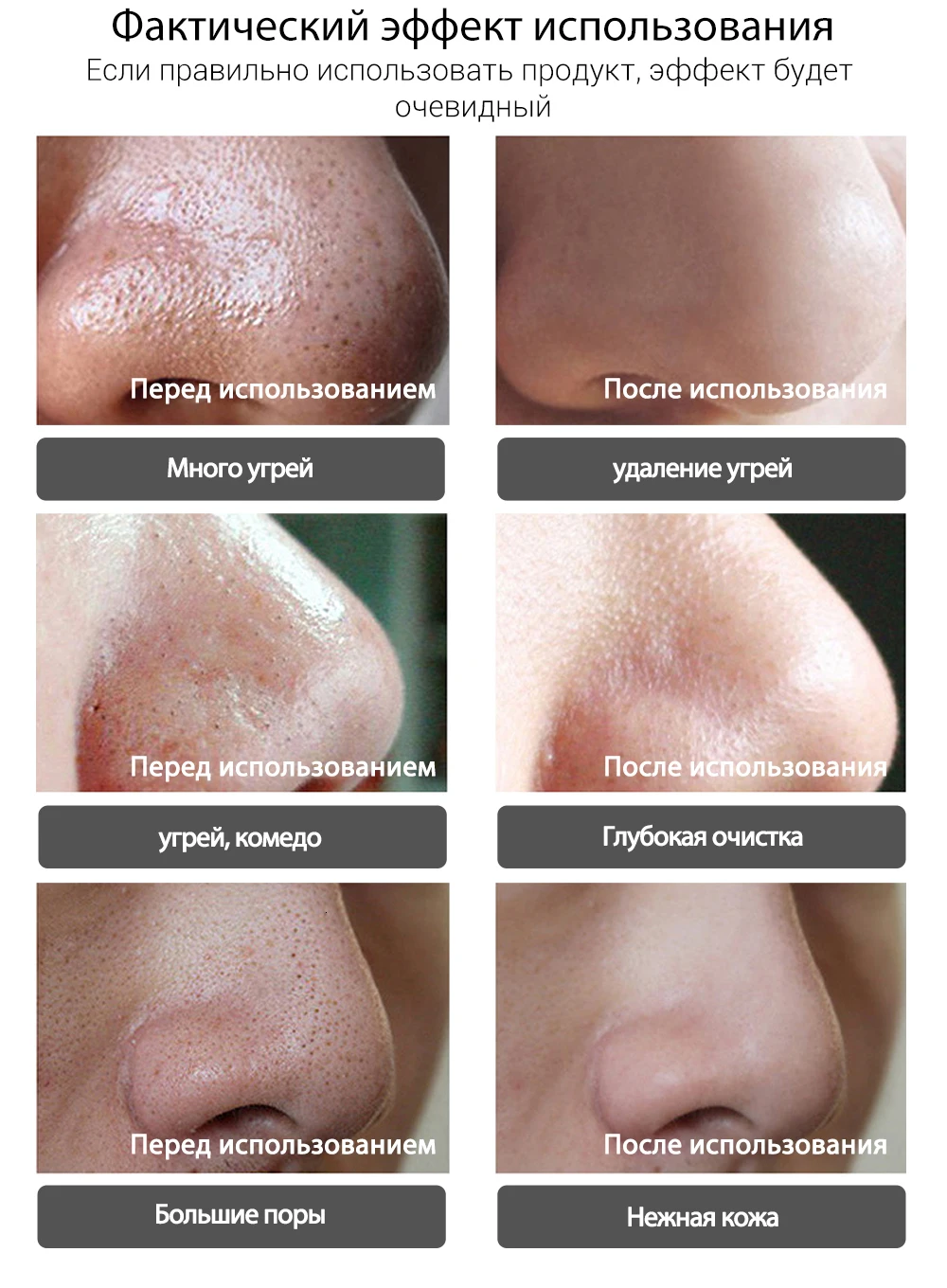 LANBENA, маска для удаления черных точек, для лица, полоска пор, черная маска для пилинга носа, лечение акне, унисекс, глубокое очищение кожи, уход за кожей, красота