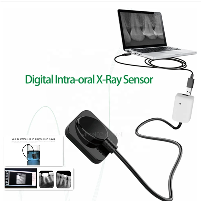Стоматологический цифровой рентгеновский датчик стоматологический