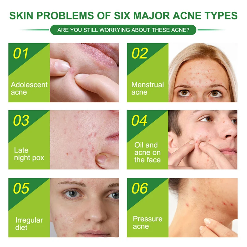 

24pcs/Bag Invisible Acne Removal Pimple Patch Face Spot Scar Treatment Stickers