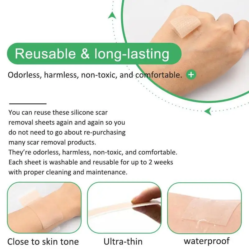 Aliver Медицинские силиконовые Гелевые полоски патч шрам от лента Уход