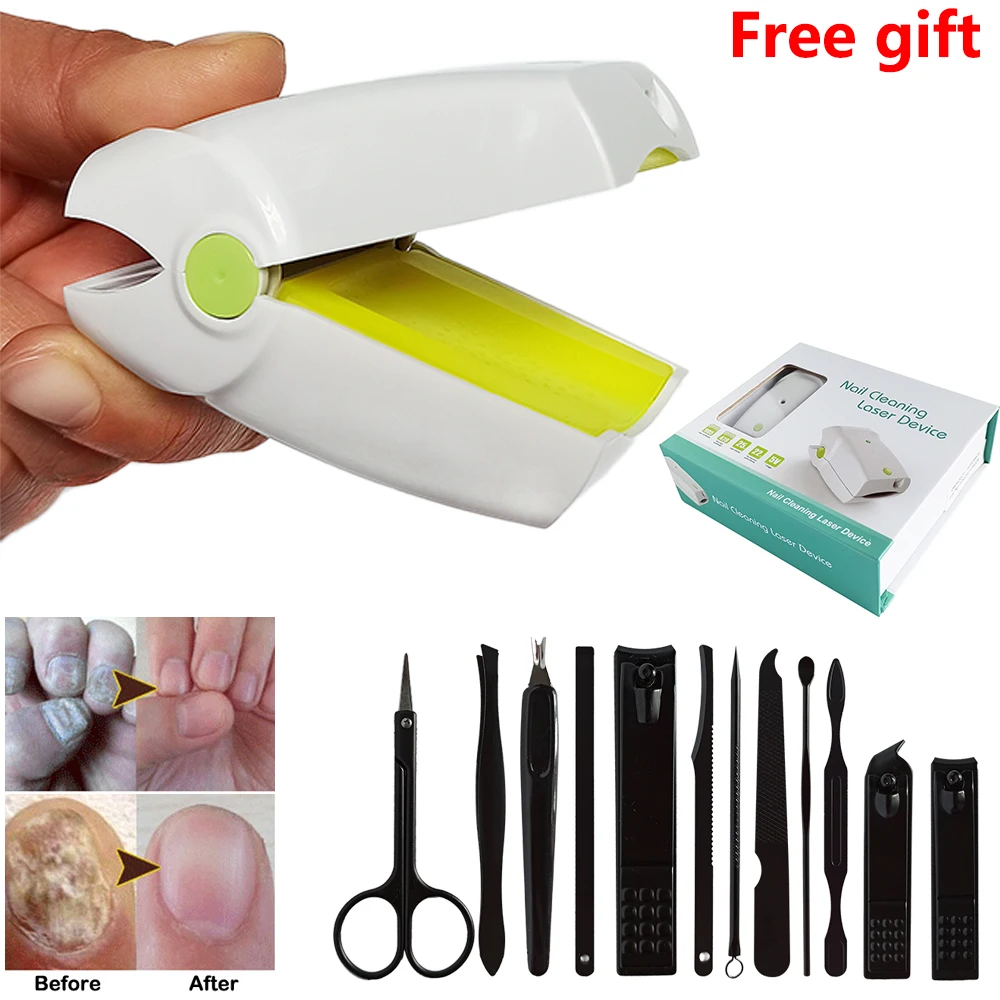 

Laser Therapy For Anti Infection Fungal Nail Treatment Foot Care Whiten Toe Nail Fungus Removal Paronychia Onychomycosis
