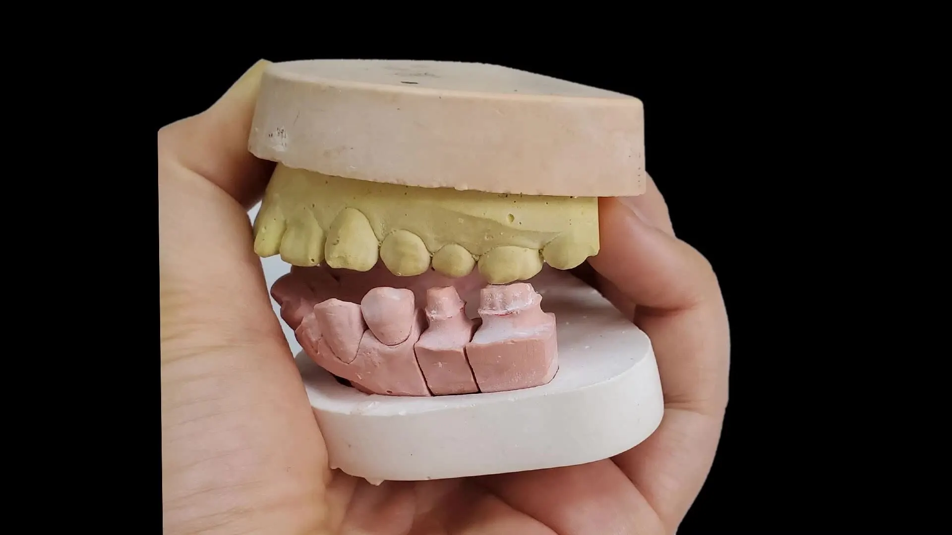 

3D Scanner for Clinic and Lab