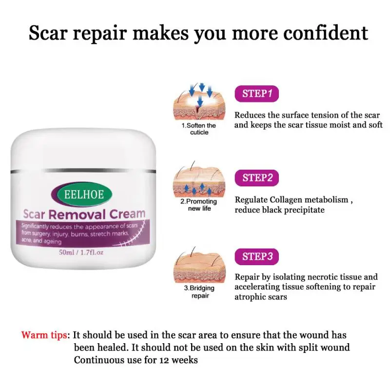 Восстанавливающий шрам крем для удаления шрамов кесарева хирургии уменьшения