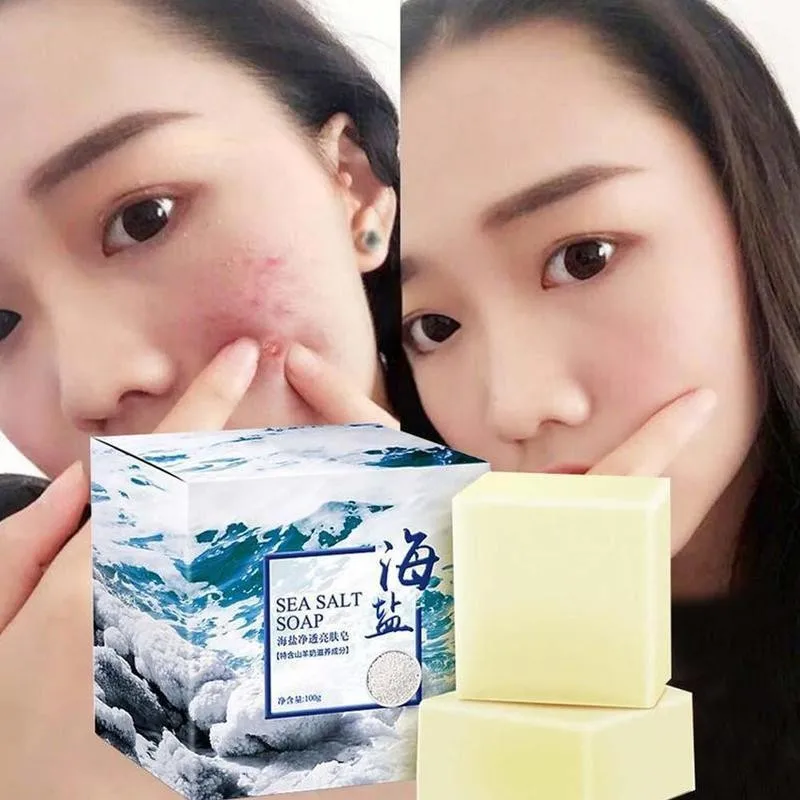 Pimple Treatment Sea Salt Soap To Remove Pimple Acne Oil Treatment And Goat Essence Milk Soap Bath Acne Soap Whitening Skin H2Q8