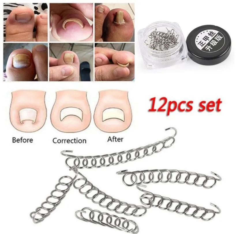 6/12 шт. корректор для вросших ног|Инструмент ухода за ступнями| |