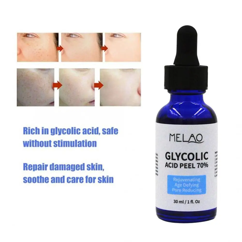 30 мл гликолевая кислота пилинг ремонт решение уменьшает поры Supplie и светильник