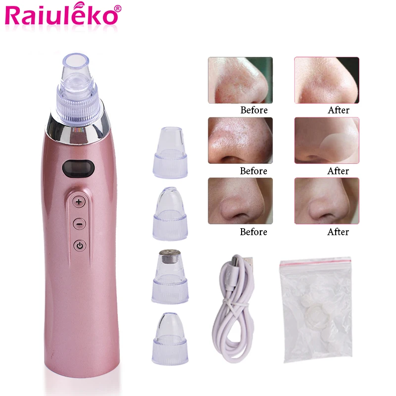 

Beauty Instrument Facial Pore Cleaner Blackhead Remover Diamond Dermabrasion Vacuum Acne Cleanser Face Tightening Skin Care