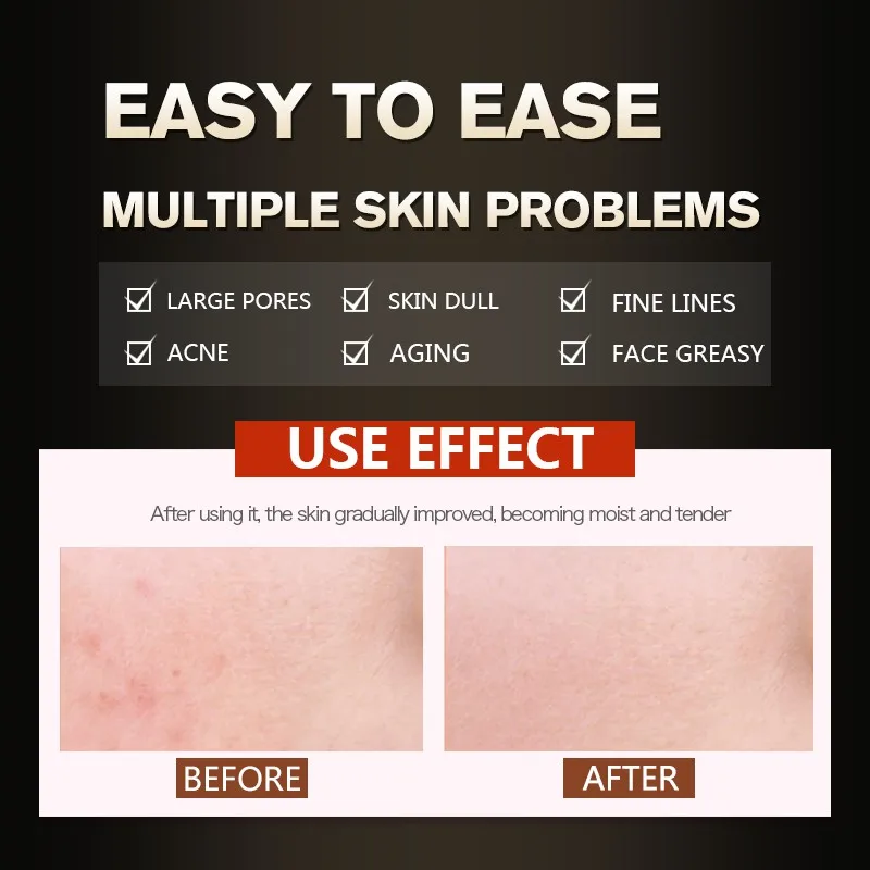 Экстракт для ухода за лицом Улитка Питание эссенция мульти эффекты экстракт