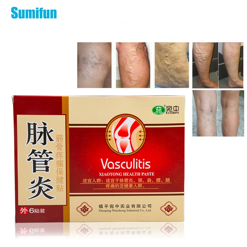 

1box Varicose Veins Treatment Plaster Varicose Veins Cure Patch Varicosity Angiitis Remedy Ointment Herbal Patches C1733