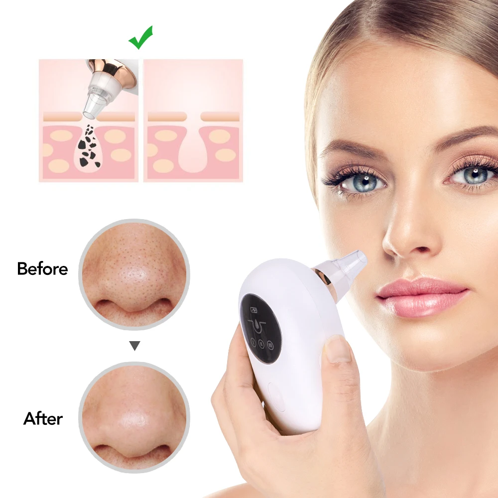 

Portable Vacuum Blackhead Remover Face Deep Pore Cleaner Acne Pimple Removal Face Skin Care Beauty Machine Tools
