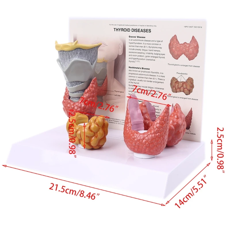 

Human Anatomical Thyroid Gland Model Pathology Anatomy Digestive System Display Study Teaching Tool
