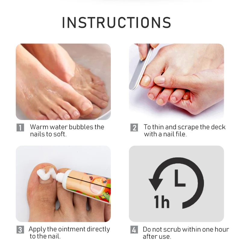 1 шт. Крем для лечения грибка ногтей Удаление паронихии онихомикоза мазь