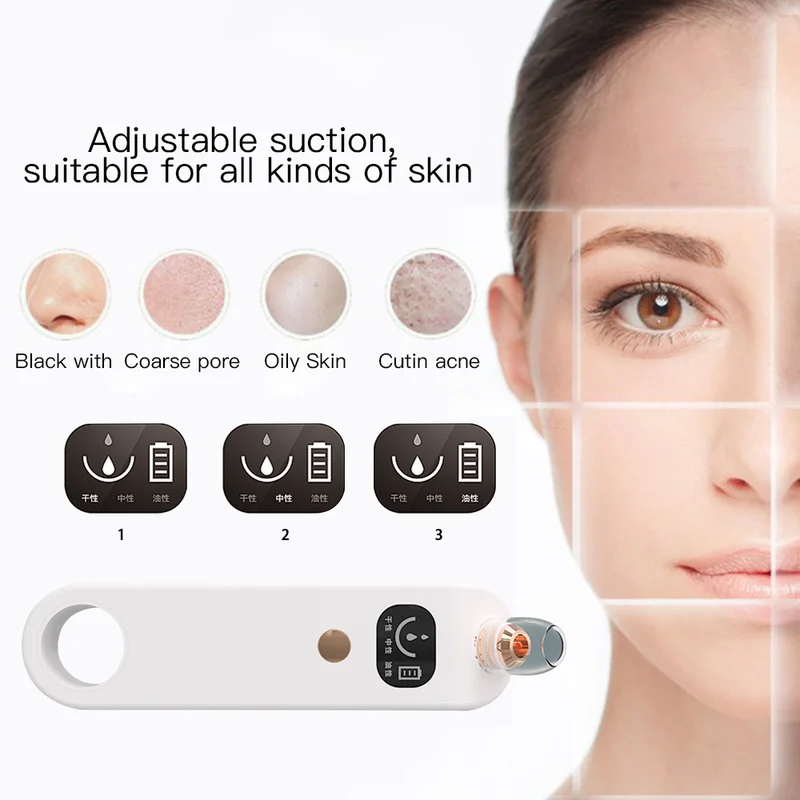 Косметический аппарат для удаления черных точек угрей вакуумный очистки пор