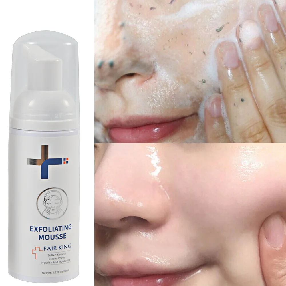 

Отшелушивающий гель для лица, скраб для лица, глубокое удаление, очищение всех типов кожи, плавное увлажнение, отшелушивающий крем, уход за л...