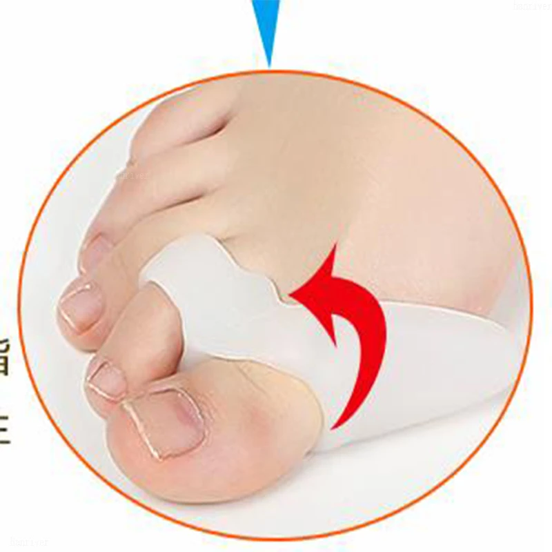 1 пара = 2 шт. корректор вальгусной деформации большого пальца ноги|thumb brace|toe support