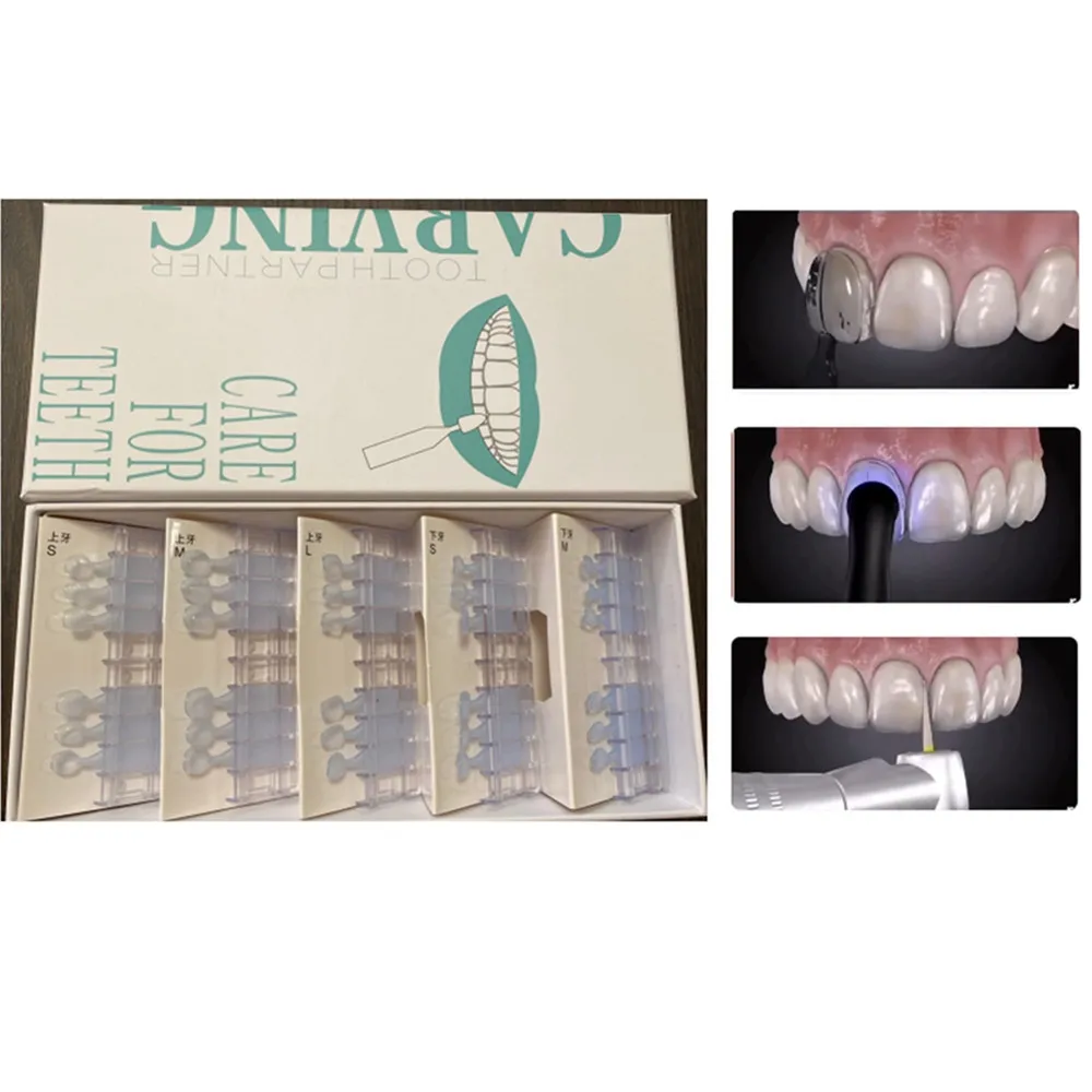 

30Pcs Dental Porcelain Veneers Adhesive Mould Composite Resin Light Cure Bonding Model Fast Quick Anterior Teeth Whitening Tool