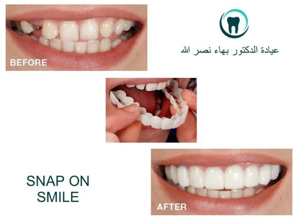 

Cosmetic Dentistry Snap On Smile Instant Smile Comfort Fit Flex Cosmetic Teeth One Size Fits Most Comfortable Denture Care