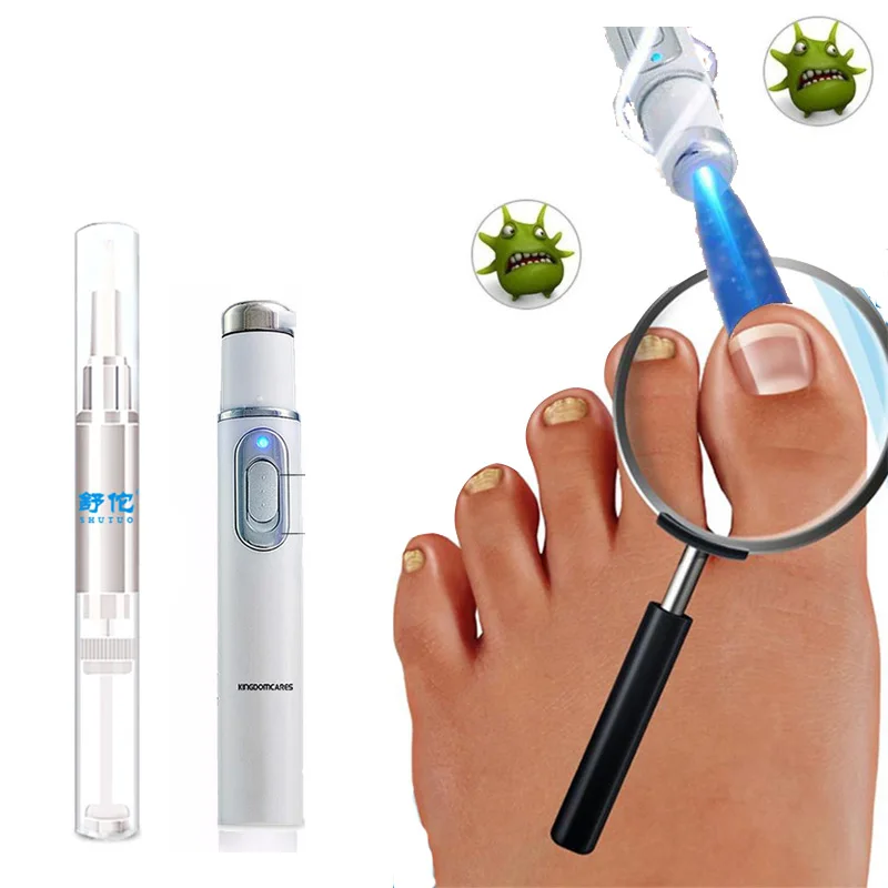 Anti-fungal Home Treatment Set Toe Nail Pen Onychomycosis Paronychia Anti Fungal Fungus Care Repair Serum Kit | Красота и здоровье