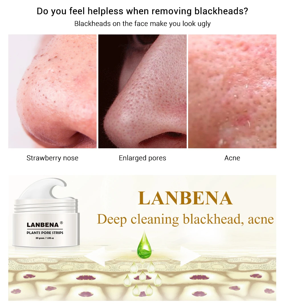 LANBENA, средство для удаления черных точек, маска для носа, полоска пор, черный пилинг, лечение акне, глубокое очищение лица, контроль жирности, уход за кожей