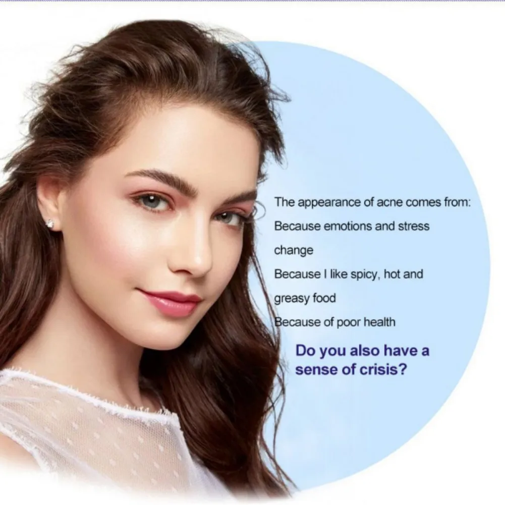 

Effective Acne Removal Cream 30g Refreshing Mild Non-irritating Treatment Scar Spots Oil Shrink Pores Skin Care 30g