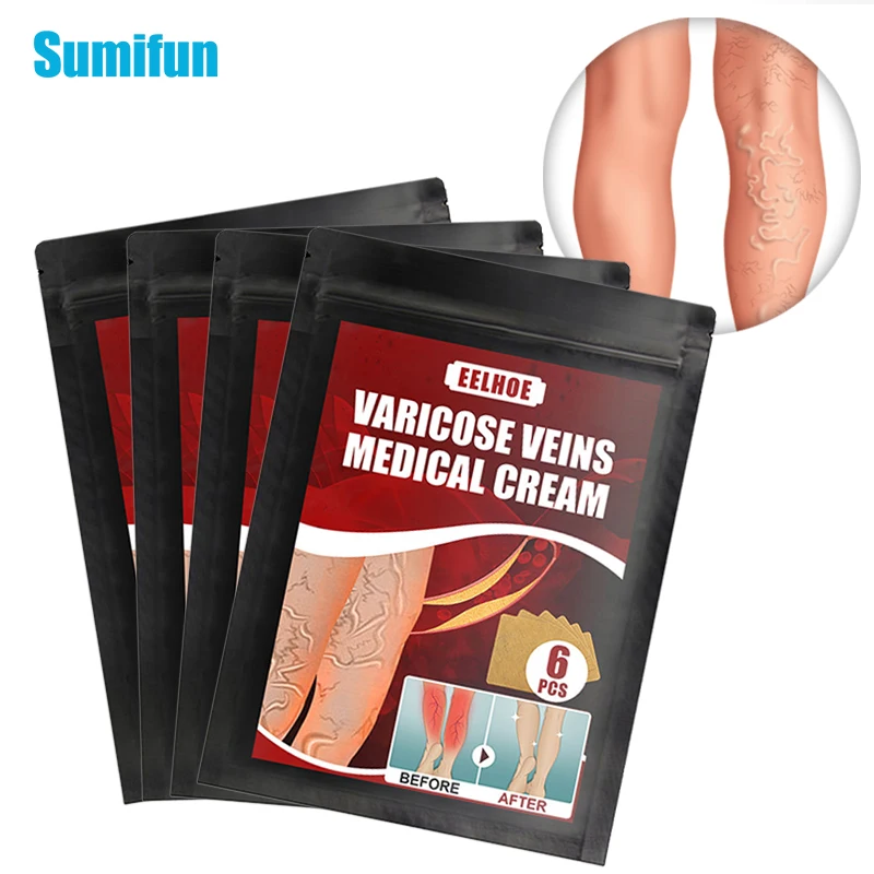 

6pcs Varicose Veins Plaster Natural Herbal Extract Sticker Cure Varicosity Angiitis Remedy Pain Relief Patch Health Care C2429
