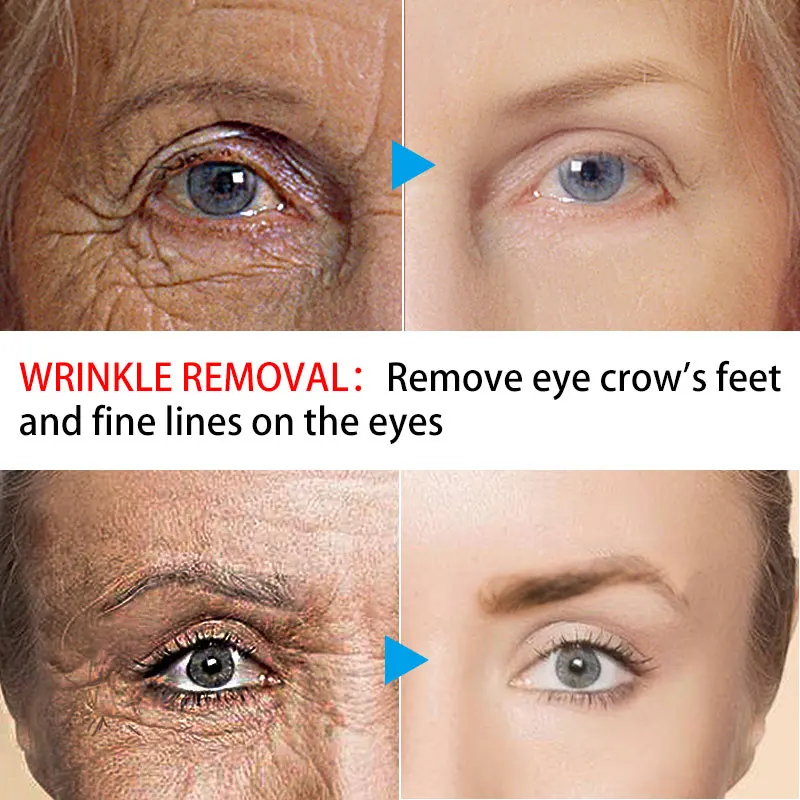 Отбеливающая Сыворотка для кожи вокруг глаз с гиалуроновой кислотой| |