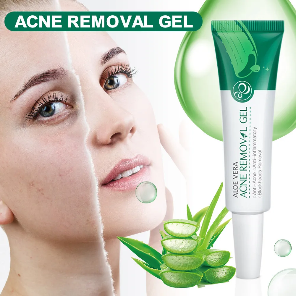 

Aloe vera acne gel cream shrink pores moisturizing oil control soothing essence anti-acne scar cream essence skin care